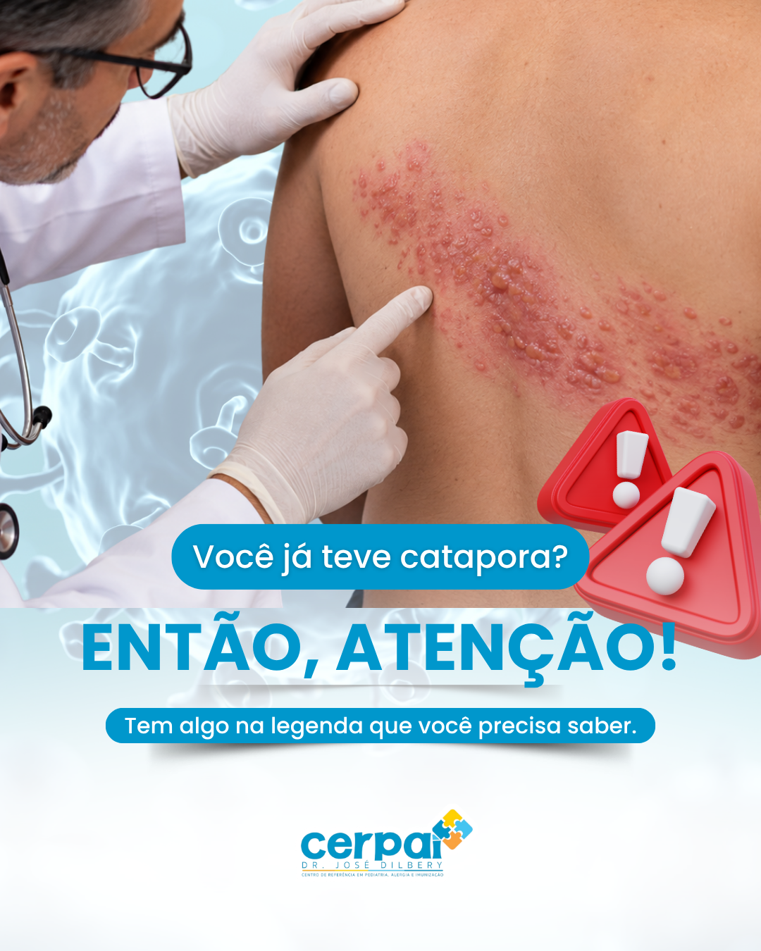 Post de feed da marca Cerpai · Dr. José Dillert: Você já teve catapora? Então, atenção!